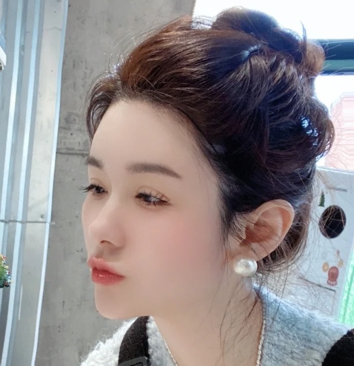 安琪